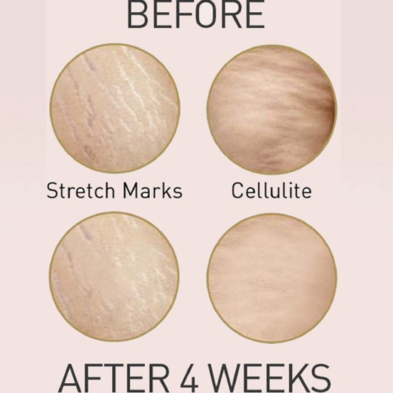 Rexaline X-treme Body Sculpt 150 ml