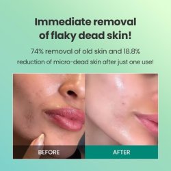 Dr.G Brightening Peeling Gel 120ml