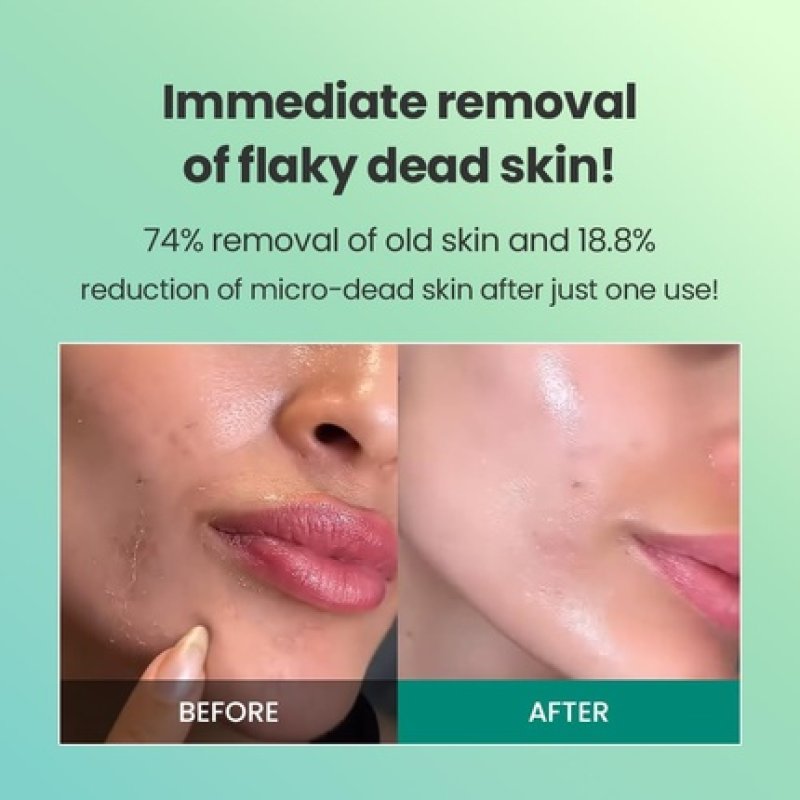 Dr.G Brightening Peeling Gel 120ml