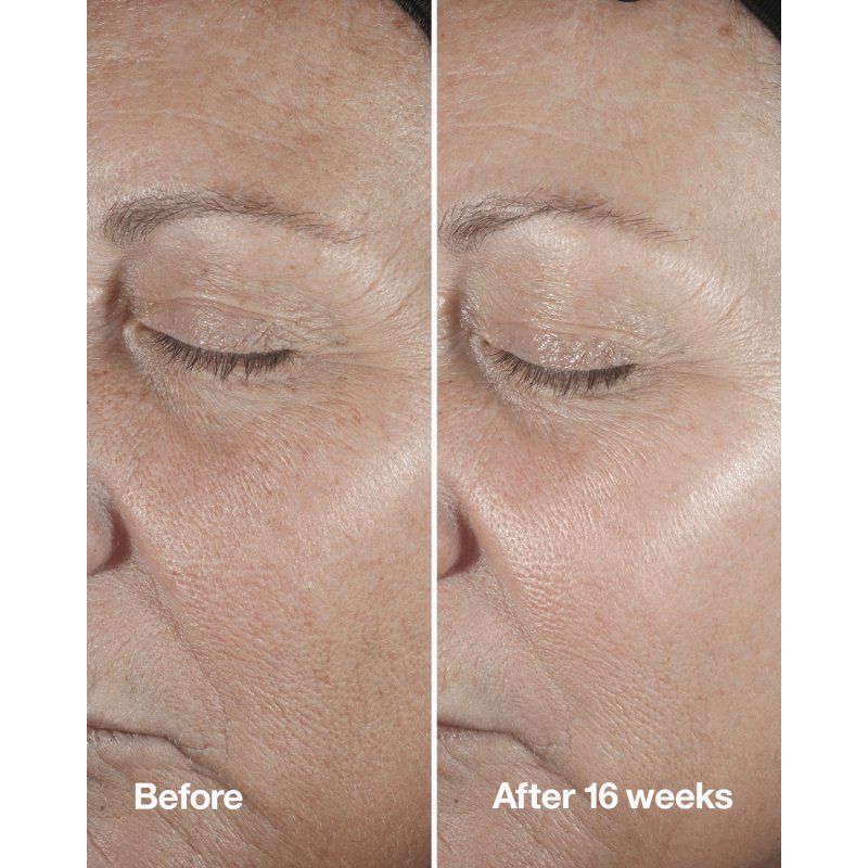 Clinique Smart Custom-Repair Wrinkle Correcting Serum 30 ml