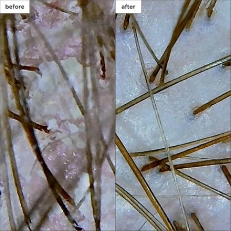 Briogeo Antidandruff Shampoo with Salicylic Acid for Dry Scalp 248ml