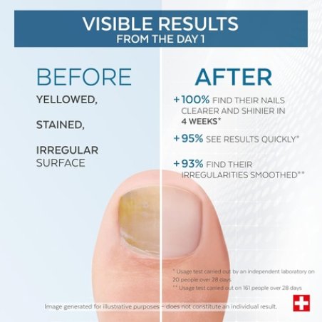 Poderm Yellow & Damaged Nails Treatment Improves Nail Appearance
