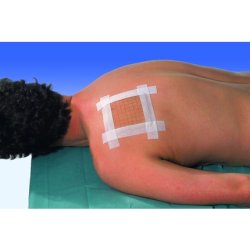 Hypoallergenic Nonwoven Adhesive Tape for Sensitive Skin 25mm x 5m White