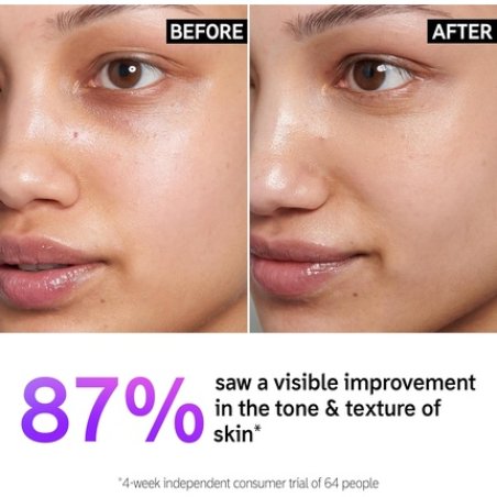 The INKEY List 15% Vitamin C and EGF Serum Intensively Brightens All Skin Types 30ml