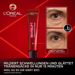 L'Oréal Paris Antibag Instant Lifting Treatment for Undereye Bags