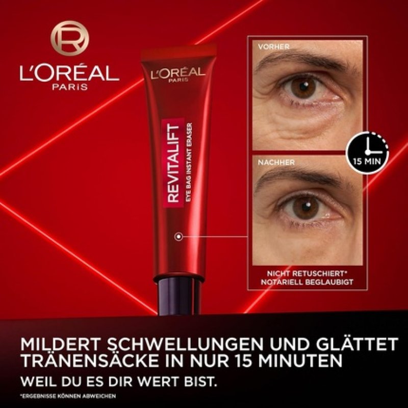 L'Oréal Paris Antibag Instant Lifting Treatment for Undereye Bags