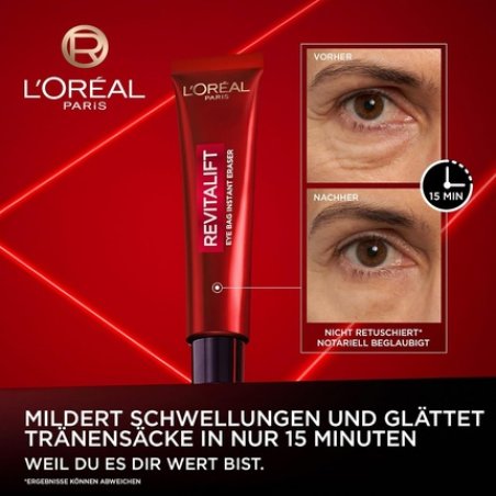 L'Oréal Paris Antibag Instant Lifting Treatment for Undereye Bags