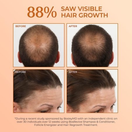 BosRevive Volumizing Shampoo & Conditioner for Thinning Hair & Regrowth with Rosemary, Sunflower & Pumpkin Seed Extract