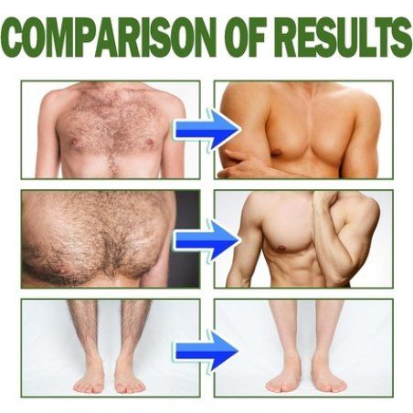Man Hair Removal Cream with Natural Aloe Vera - Quick and Gentle Hair Remover