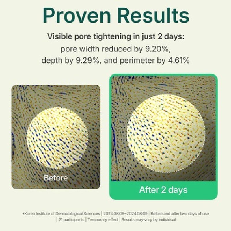 Centellian 24 Madeca Powder Tea Tree AC Calming Powder 60g Oil Control