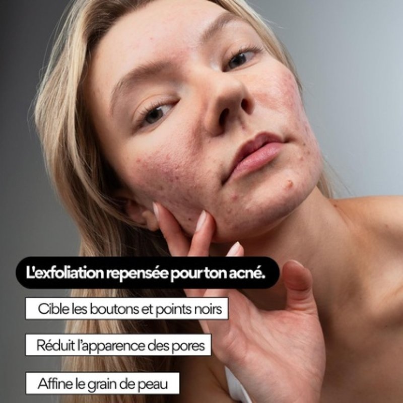 Skin & Out Grain-Free Exfoliating Mask 100% Natural Chemical Exfoliation