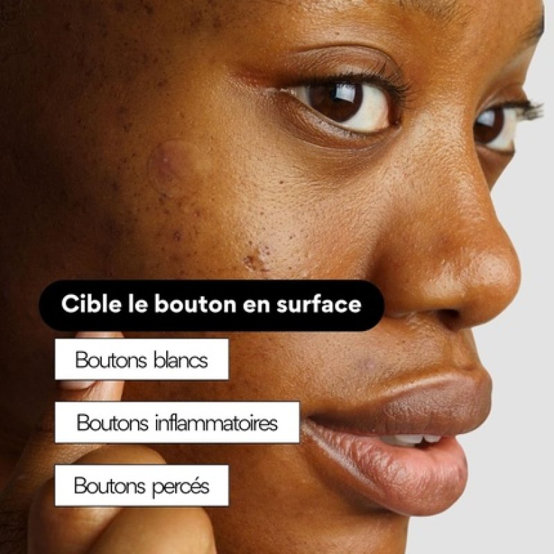 Skin & Out Ultrathin Spot Treatment Patches X23 Almost Invisible