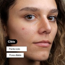 Skin & Out Peel Out Cleansing Nose Pads for Acne Treatment