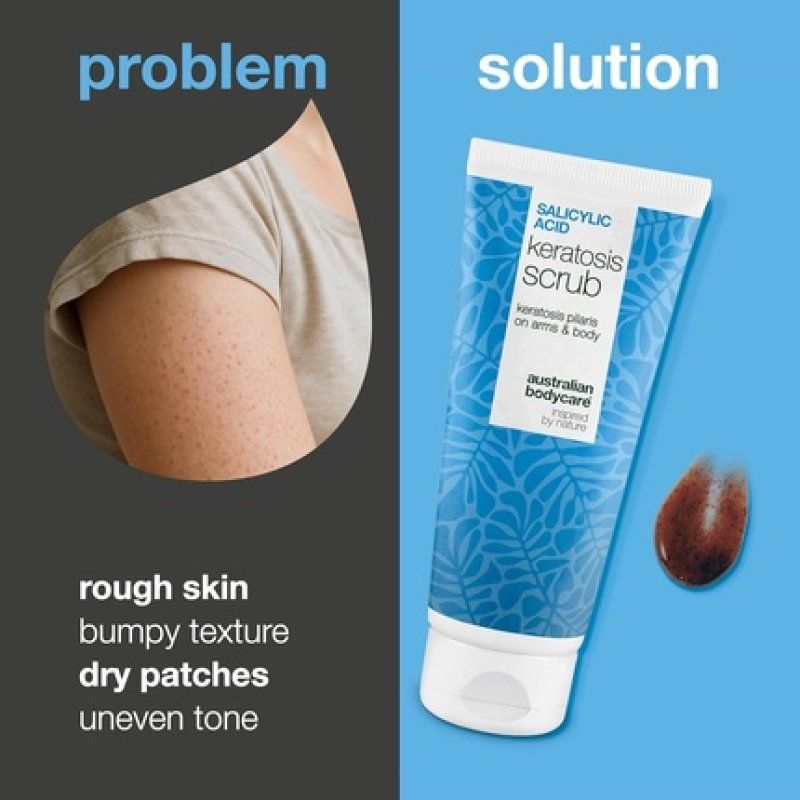 Keratosis Pilaris Body Scrub Treatment - Chemical AHA/BHA Physical Exfoliant