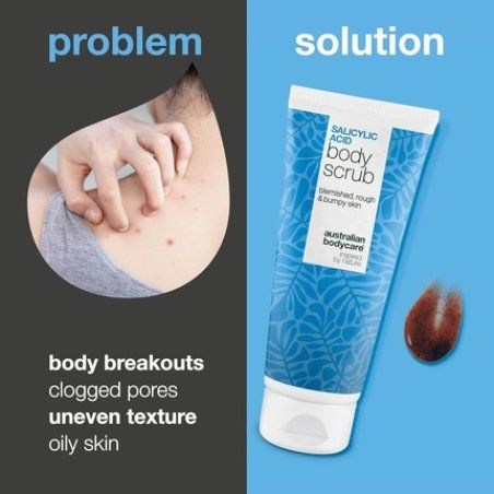 Salicylic Acid Body Exfoliator Scrub for Back, Bum, and Chest Spots