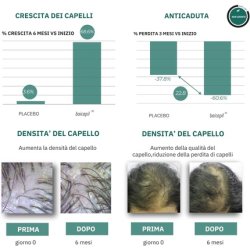 Antihair Loss Lotion for Men and Women Strengthening and Stimulating Treatment