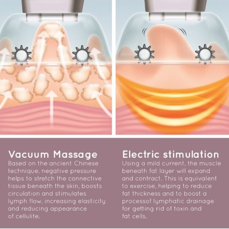 Homedics CELL-500-EU Smoothee