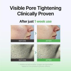 Izeze Exosome PDRN Booster Ampoule Pore Minimizing and Firming Cica Exosomes