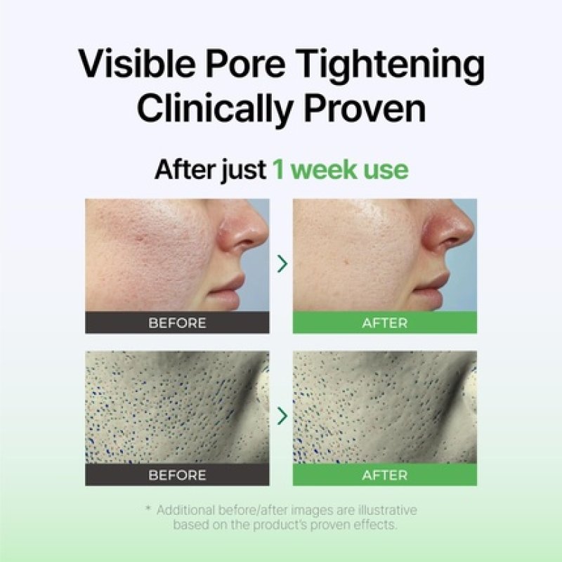 Izeze Exosome PDRN Booster Ampoule Pore Minimizing and Firming Cica Exosomes