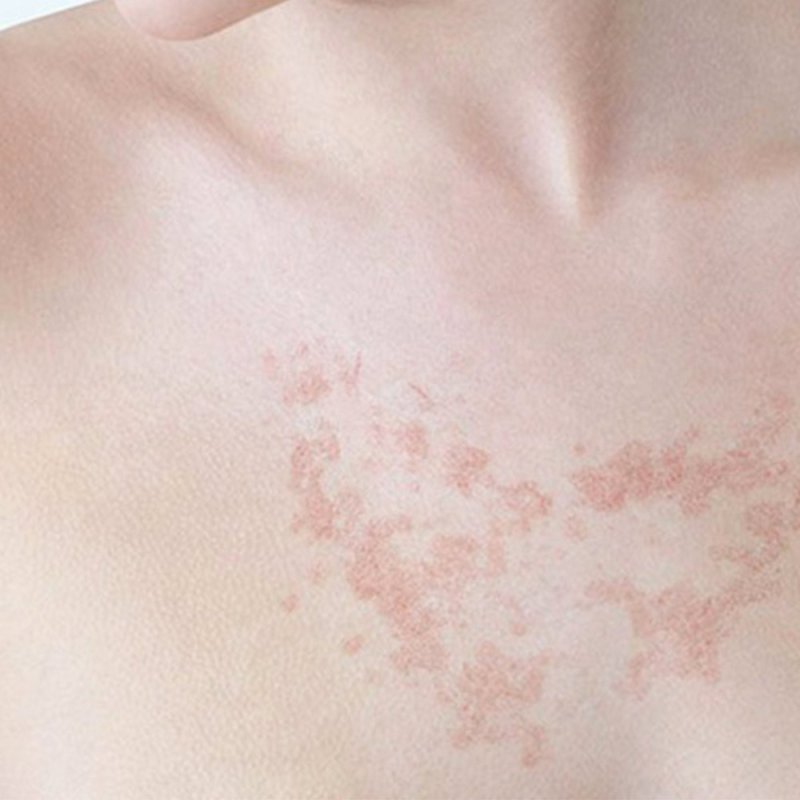 ISDIN FotoUltra Solar Allergy Fusion Fluid SPF 100 Crème d’écran solaire Visage et corps Adultes