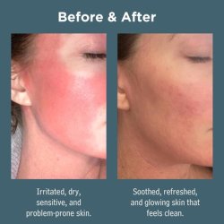 Sea Magik Tea Tree Face Wash for Acne Prone Skin - Gentle and Hydrating