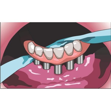 iDontix X-Ribbon Dental Gauze Floss 12m